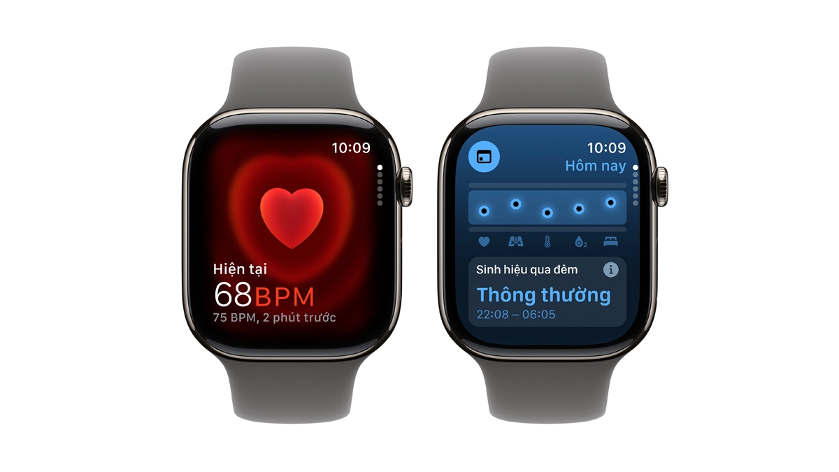 Apple S10 cũ có mấy phiên bản dây?