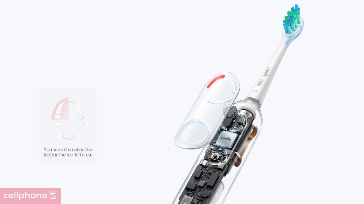 Công nghệ bảo vệ nướu chủ động