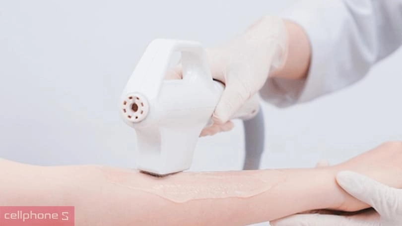 Chọn máy triệt lông theo bóng xung điện Chọn máy triệt lông theo bóng xung điện