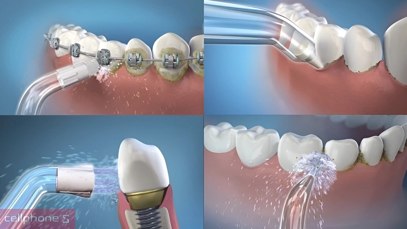 Máy tăm nước Halio Ultraclean Express Hydro Floss